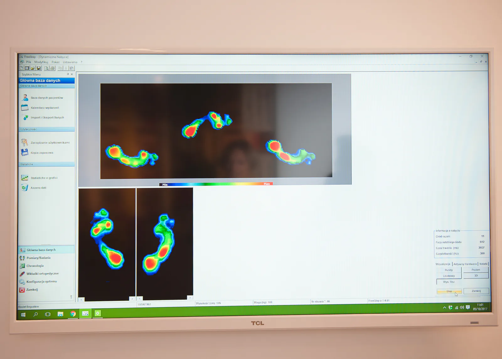 Skanowanie stopy podczas diagnostyki
